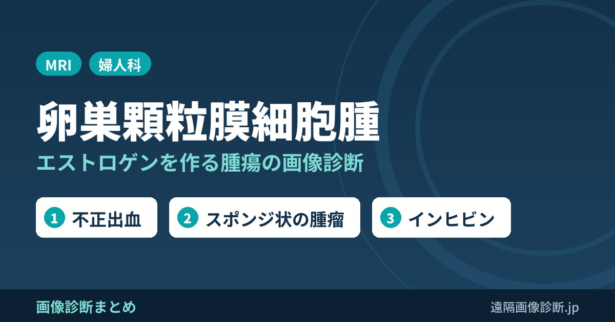 顆粒膜細胞腫の画像診断