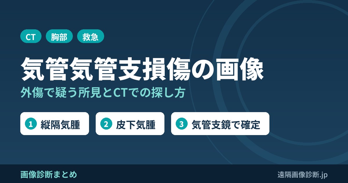 気管気管支断裂(損傷)の画像診断