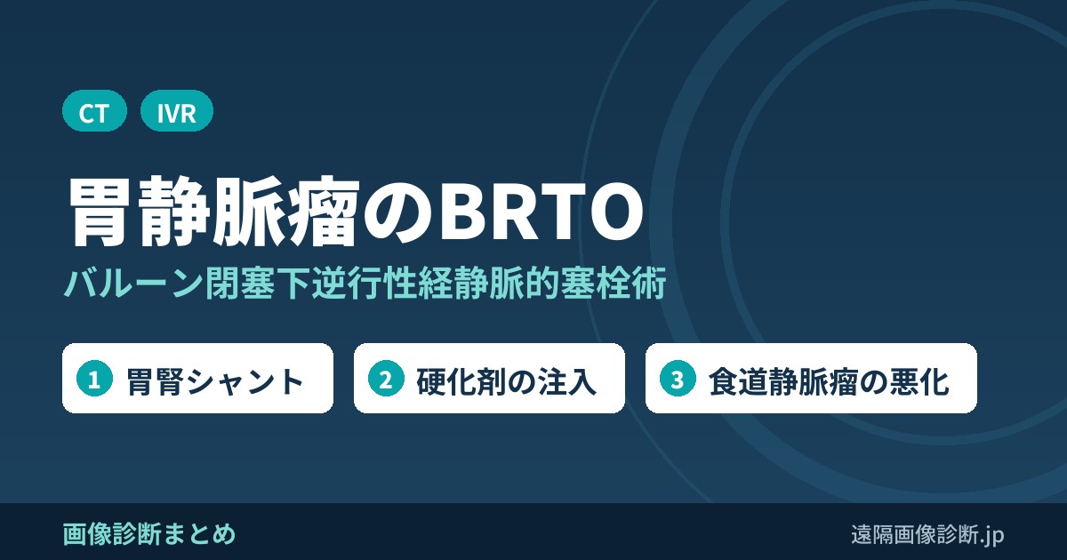 BRTOとは？胃静脈瘤の治療(バルーン閉塞下逆行性経静脈的塞栓術)の方法・適応・合併症