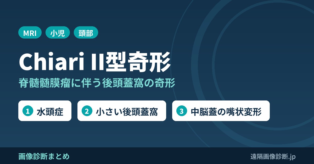 ChiariⅡ奇形とは？(脊髄髄膜瘤、脊髄空洞症)