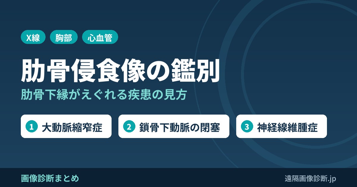 肋骨侵食像(rib notching)を示す疾患の鑑別