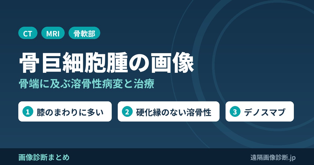 骨巨細胞腫のCT・MRI画像所見｜骨端に及ぶ溶骨性病変と治療