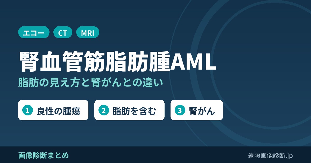 腎血管筋脂肪腫(AML)とは？エコー・CT・MRI画像所見(脂肪)と腎がんとの違い、治療
