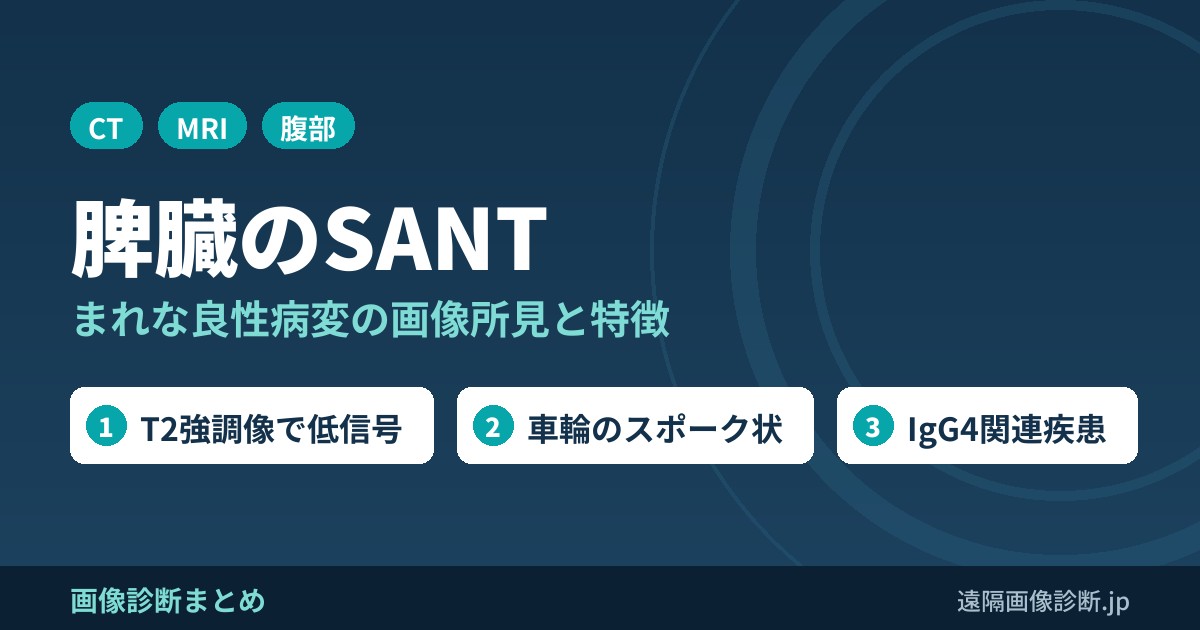 脾臓のSANT(硬化性血管腫様結節性形質転換)とは？CT・MRI・PET画像所見