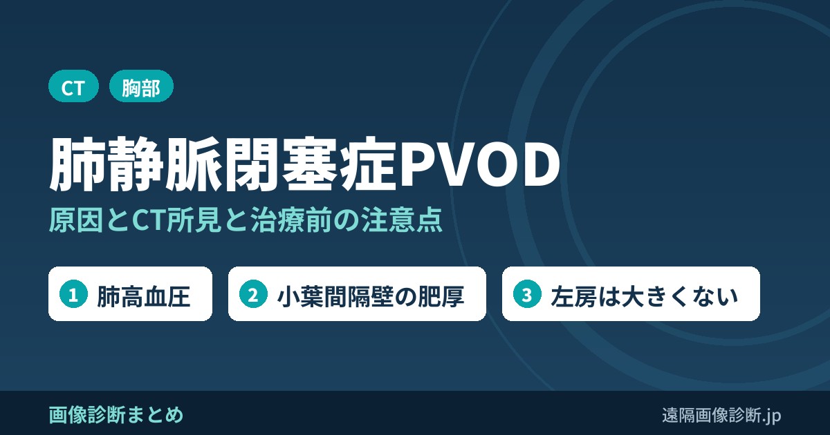 肺静脈閉塞症(PVOD)とは？原因は？CT所見は？