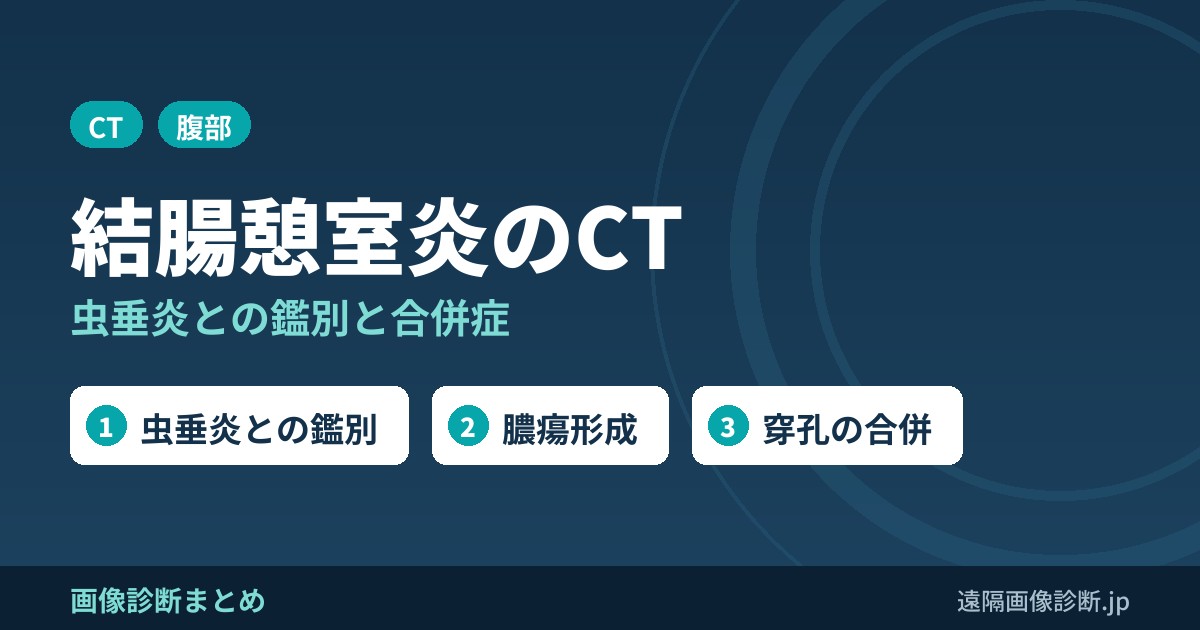 結腸憩室炎のCT画像診断｜虫垂炎との鑑別・合併症(膿瘍・穿孔)と治療