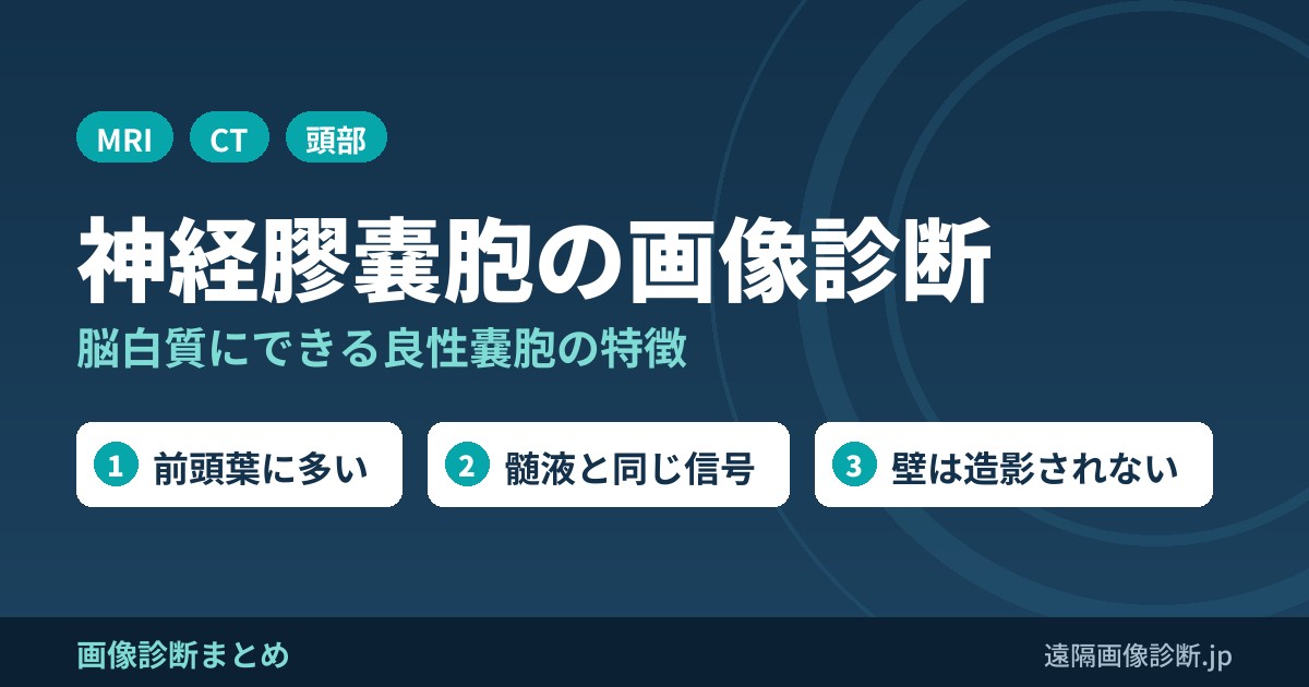 神経膠嚢胞(neuroglial cyst)とは？画像診断のポイントは？