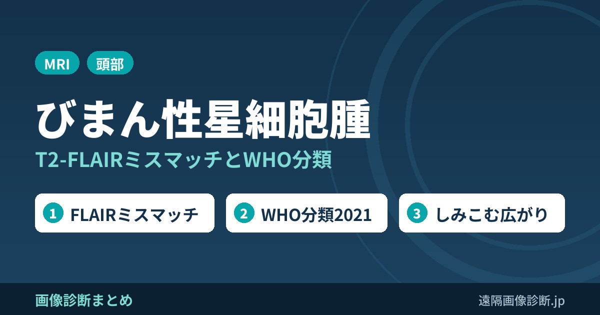 びまん性星細胞腫のMRI画像診断｜T2-FLAIRミスマッチとWHO分類2021
