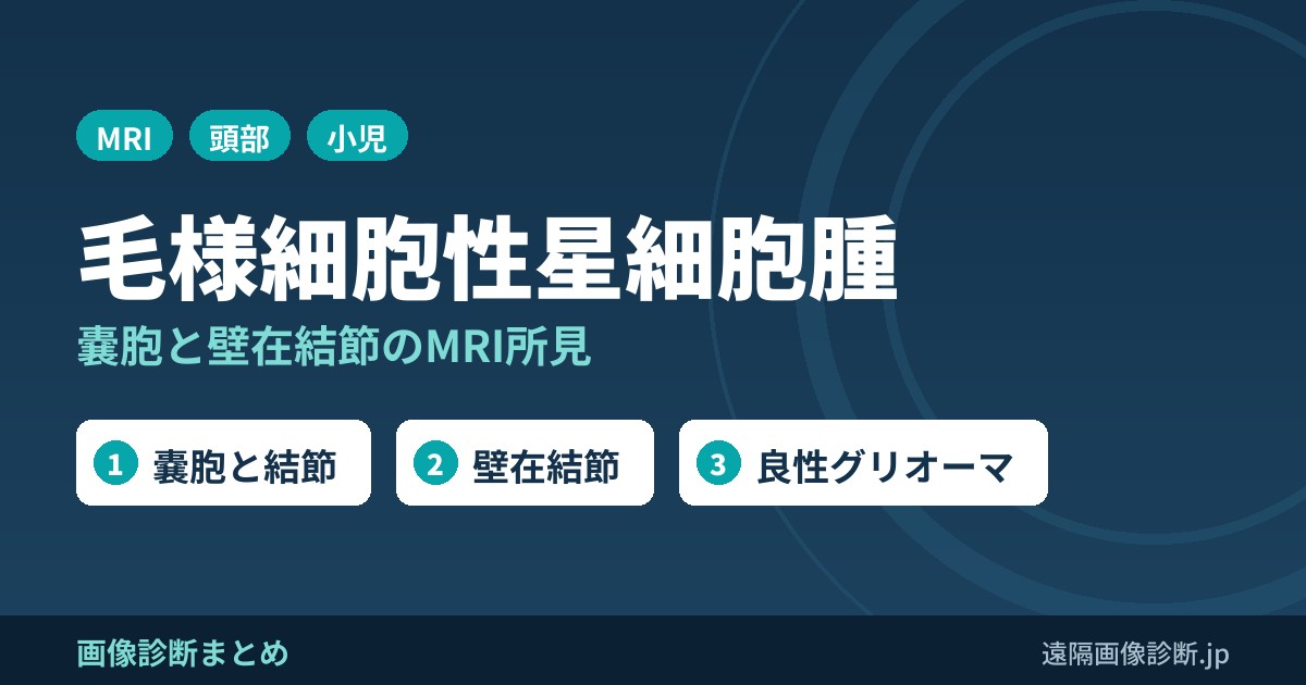 毛様細胞性星細胞腫(pilocytic astrocytoma)のMRI画像所見｜嚢胞と壁在結節