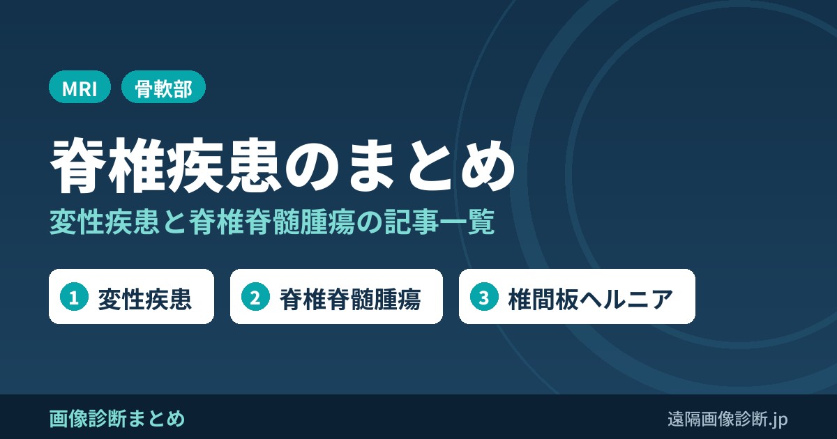 脊椎疾患の画像診断まとめ｜変性疾患・脊椎脊髄腫瘍の記事一覧