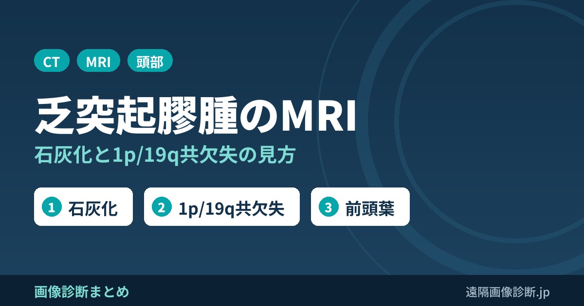 乏突起膠腫(oligodendroglioma)のCT・MRI画像所見｜石灰化と1p/19q共欠失