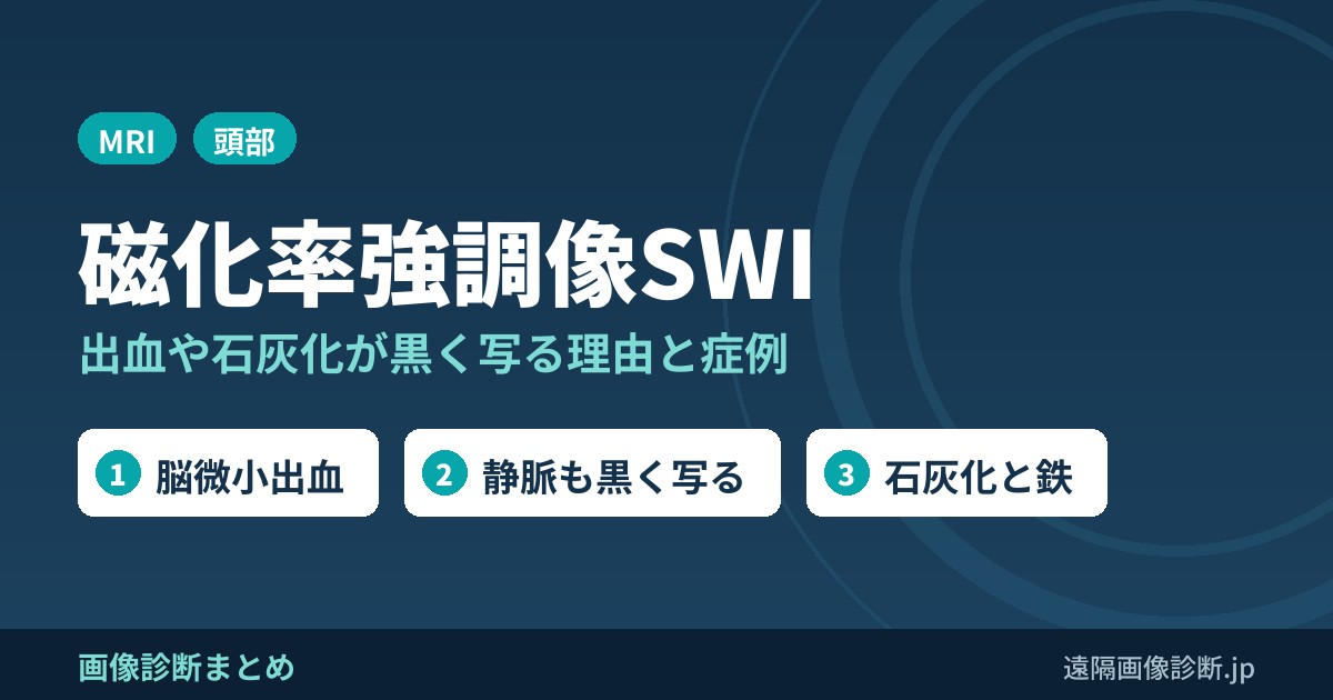 T2*強調像・磁化率強調像(SWI)とは？出血・微小出血・石灰化が黒く写る理由と症例