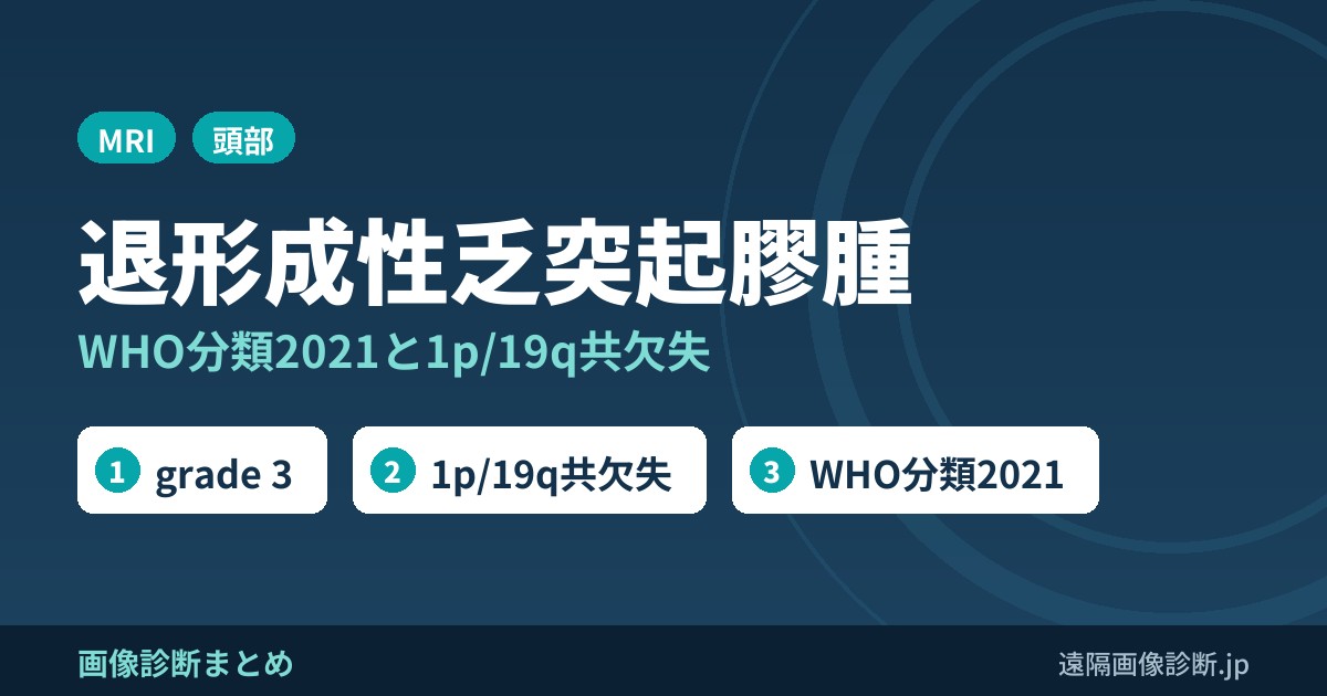 退形成性乏突起膠腫の画像所見｜WHO分類2021(grade 3)と1p/19q共欠失