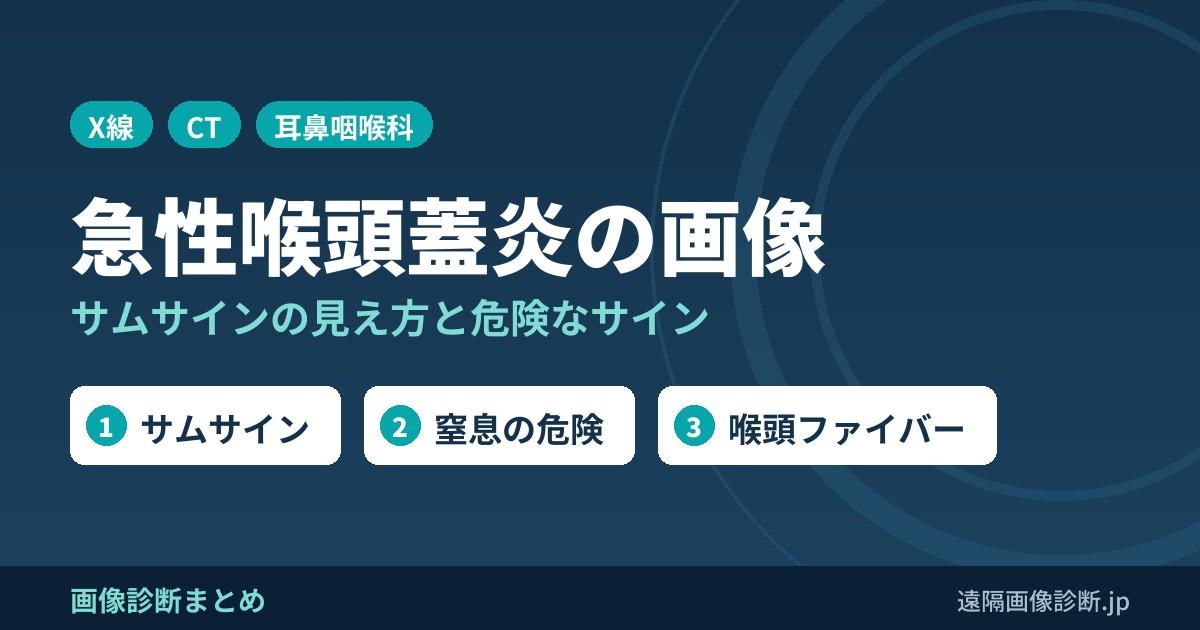 急性喉頭蓋炎の画像所見｜サムサイン(thumb sign)とは？レントゲン・CTでの見え方と危険なサイン