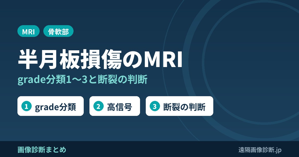 半月板断裂・損傷のMRI画像所見｜grade分類(1〜3)と断裂の判断