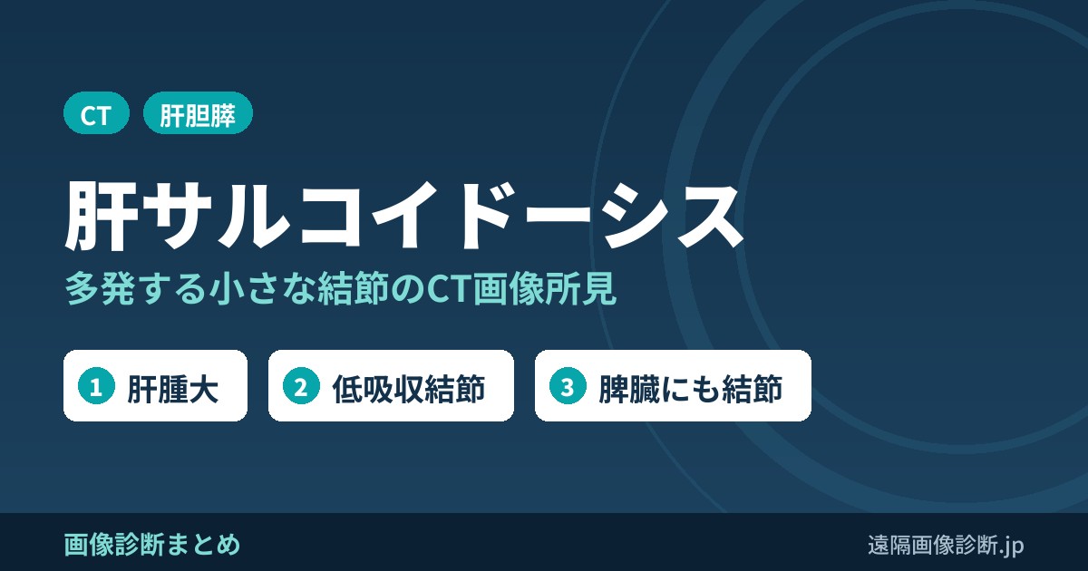 肝サルコイドーシスの画像所見のポイント