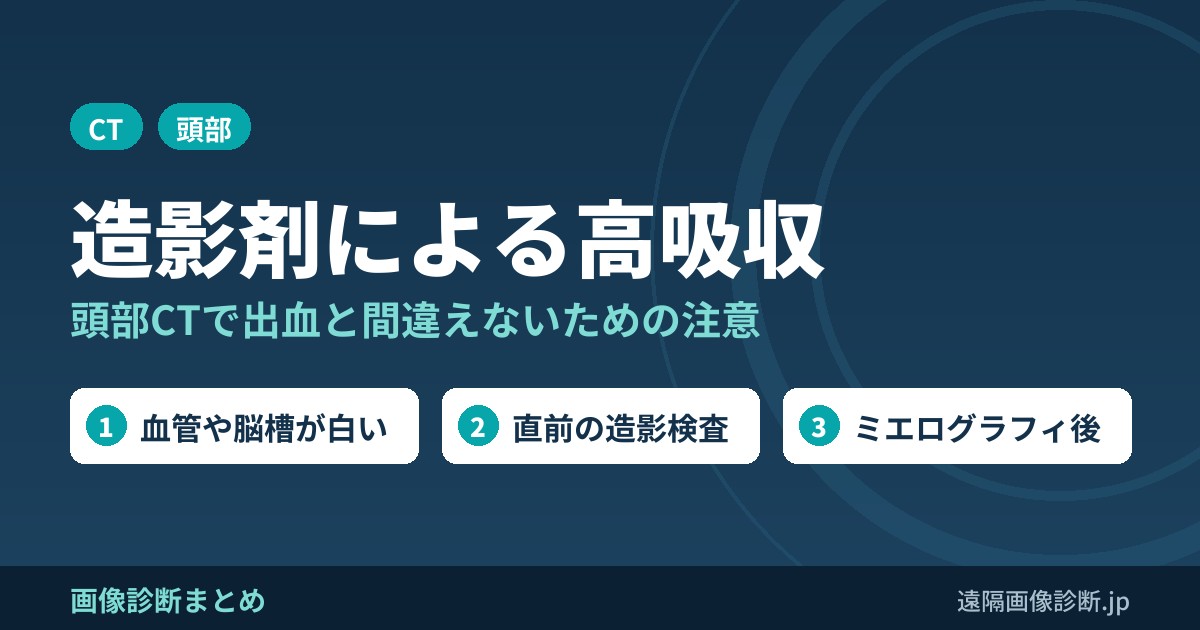 造影剤による頭部CTの高吸収