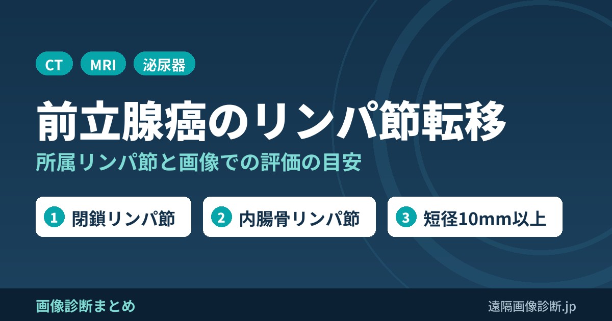 前立腺癌のリンパ節転移の画像診断｜所属リンパ節(閉鎖・内腸骨・外腸骨)とCT・MRI