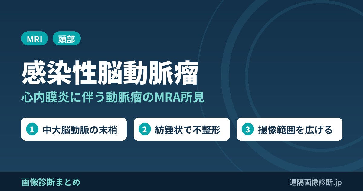 感染性脳動脈瘤のMRI(MRA)画像所見のポイント