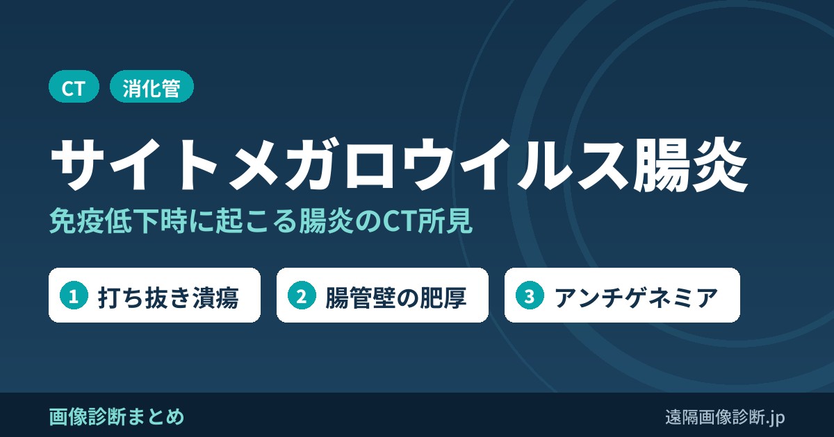 サイトメガロウイルス腸炎のCT画像所見