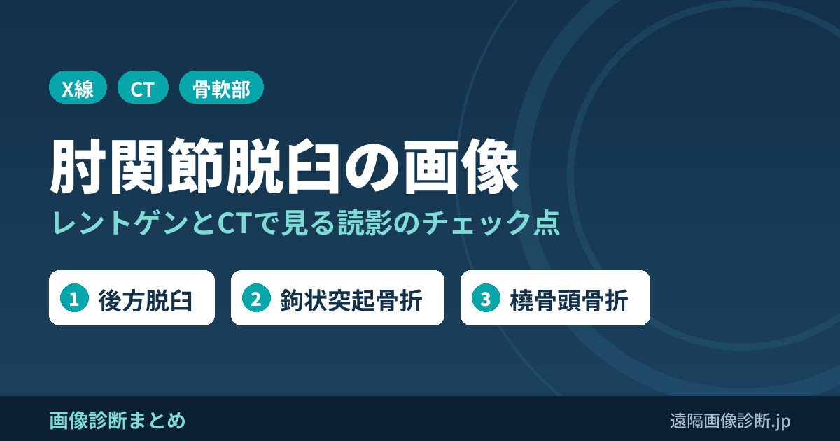 肘関節脱臼の画像所見とレントゲン・CT読影の際にチェックすべき点