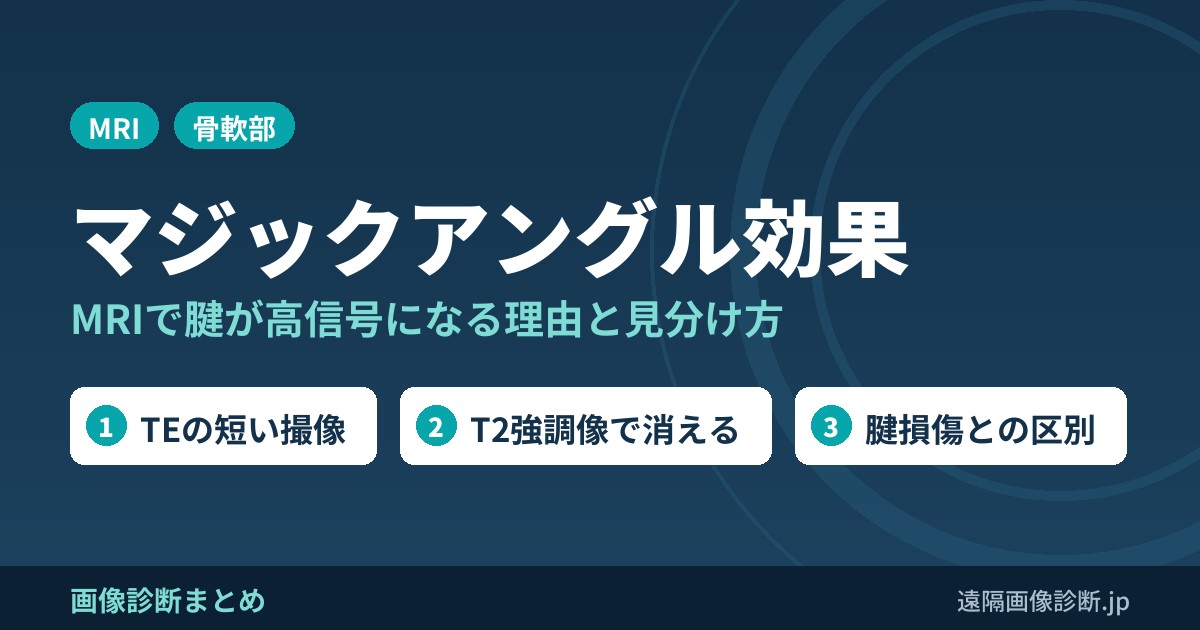 Magic angle effect(マジックアングル効果)とは？MRIで腱が高信号になる理由と見分け方