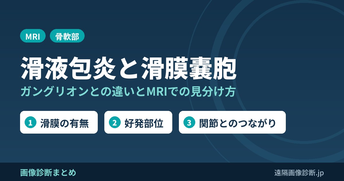 滑液包炎・滑膜嚢胞・ガングリオンの違い｜MRI画像診断と好発部位