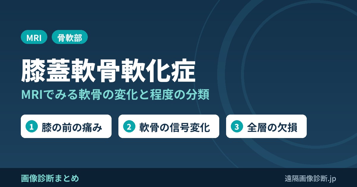 膝蓋骨軟骨軟化症(膝蓋軟骨軟化症)の画像診断のポイント