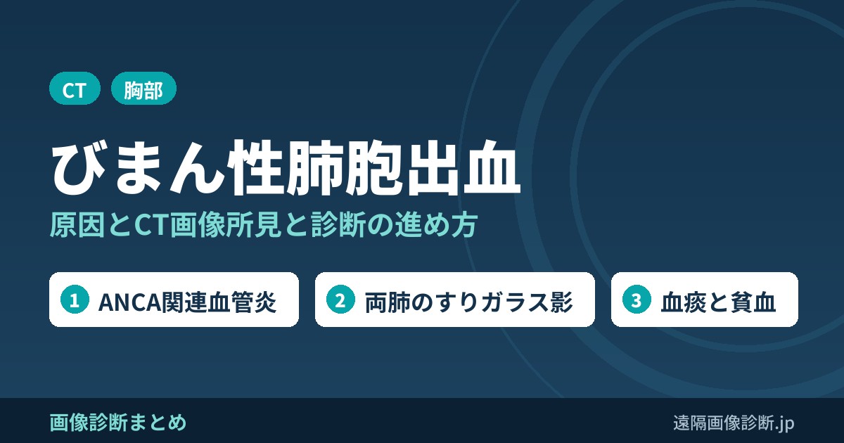 びまん性肺胞出血(DAH)の原因とCT画像所見｜血管炎・SLE・薬剤