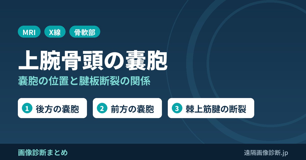 上腕骨頭の嚢胞と腱板断裂の関係