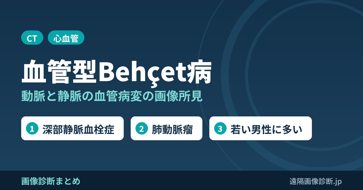 血管型Behçet病(血管ベーチェット)の血管病変