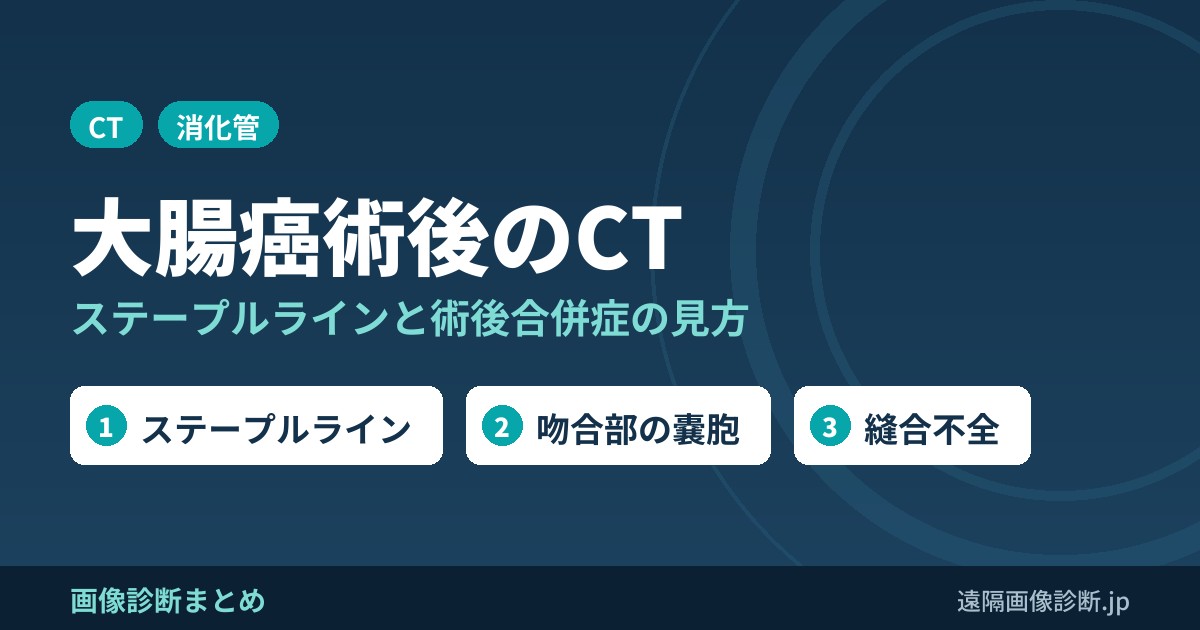 大腸癌術後のCT画像診断｜ステープルライン・implantation cyst・縫合不全・傍ストーマヘルニア