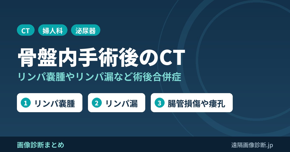 骨盤内手術後の合併症のCT画像診断｜リンパ嚢腫(lymphocele)・リンパ漏・尿嚢腫・瘻孔