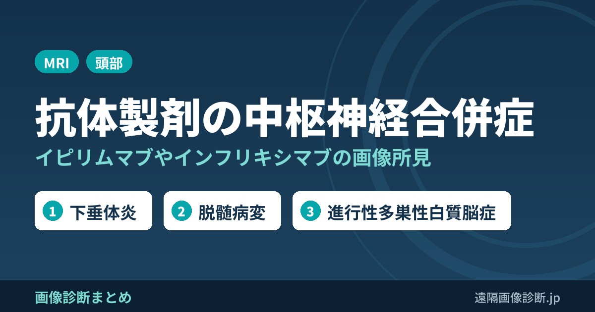 免疫チェックポイント阻害剤・抗体製剤による中枢神経合併症