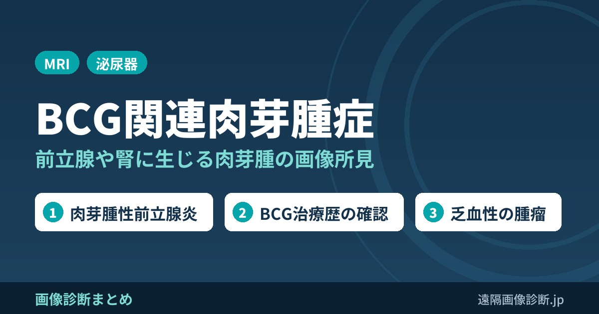 BCG関連肉芽腫症(肉芽腫性前立腺炎、腎肉芽腫症など)の画像所見のポイント