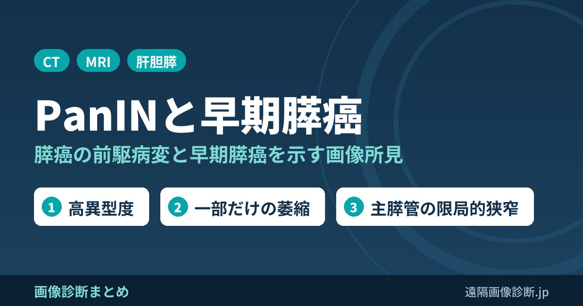 PanIN(膵上皮内腫瘍性病変)とは？膵癌の前駆病変と早期膵癌を示唆するCT・MRI所見