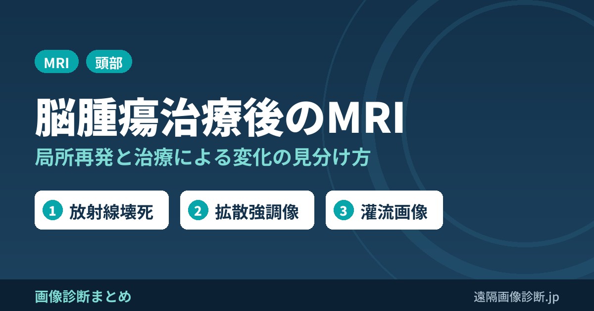 脳腫瘍の治療法と治療後の局所再発のMRI画像診断のポイント