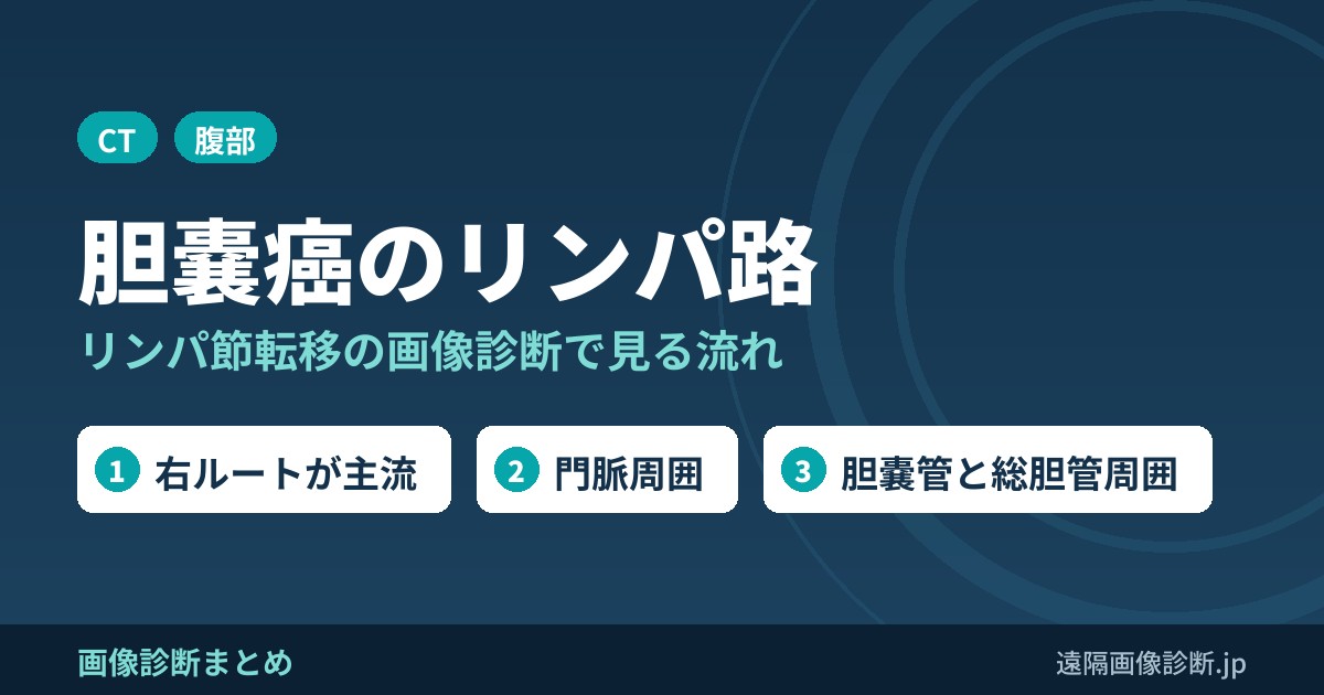 胆嚢癌のリンパ節転移の画像診断で重要な胆嚢のリンパ路の流れとは？