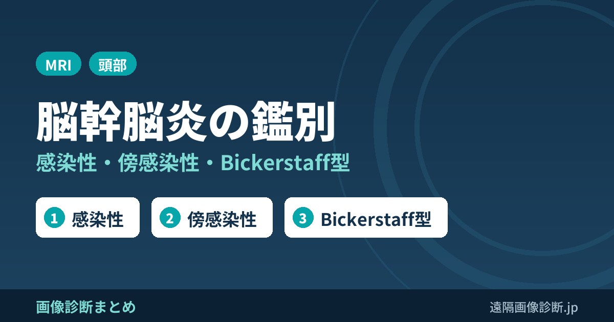 脳幹脳炎の鑑別診断｜感染性・傍感染性・Bickerstaff型とMRI