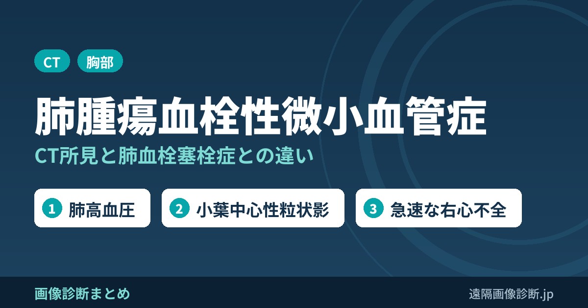 肺腫瘍血栓性微小血管症(PTTM)とは？CT画像所見と肺血栓塞栓症との違い