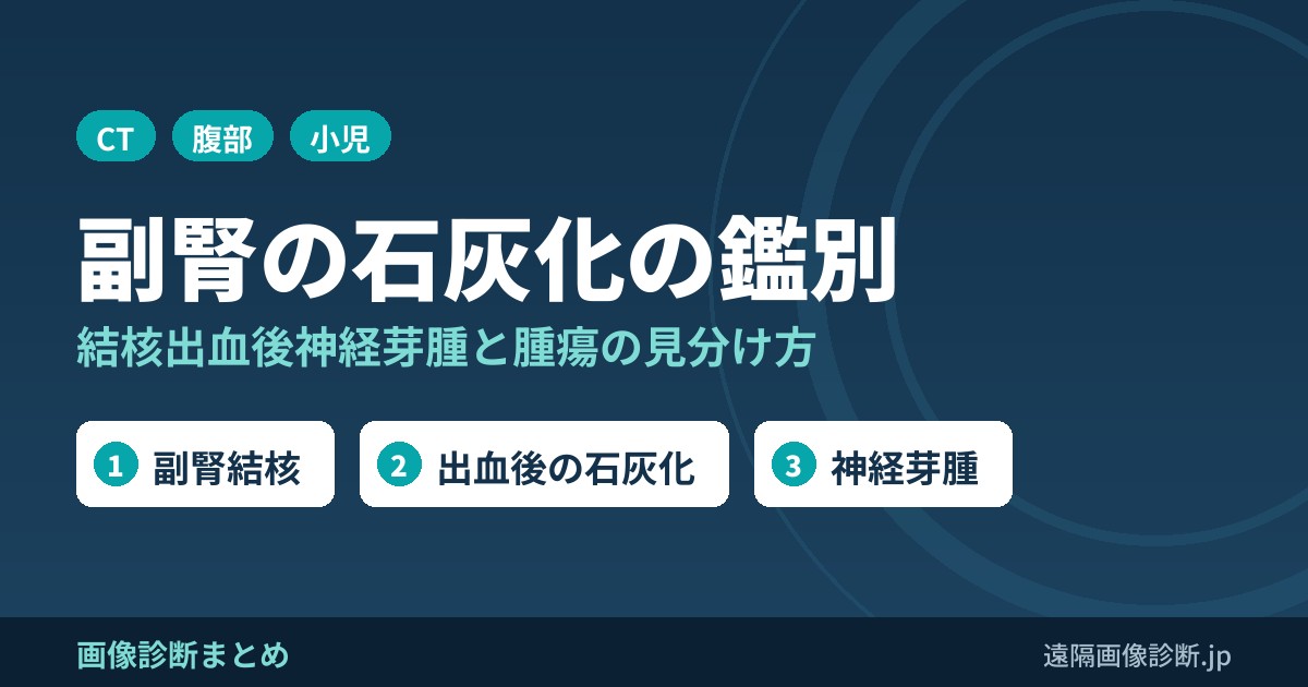 腹部CTで副腎に石灰化を認めたときの鑑別診断｜結核・出血後・神経芽腫・腫瘍