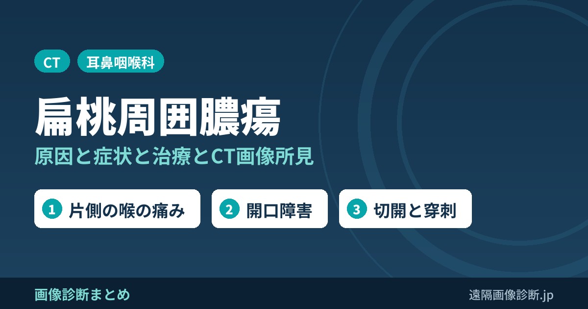 扁桃周囲膿瘍とは？原因・症状(片側の喉の痛み・開口障害)と治療(切開・穿刺)、CT画像所見