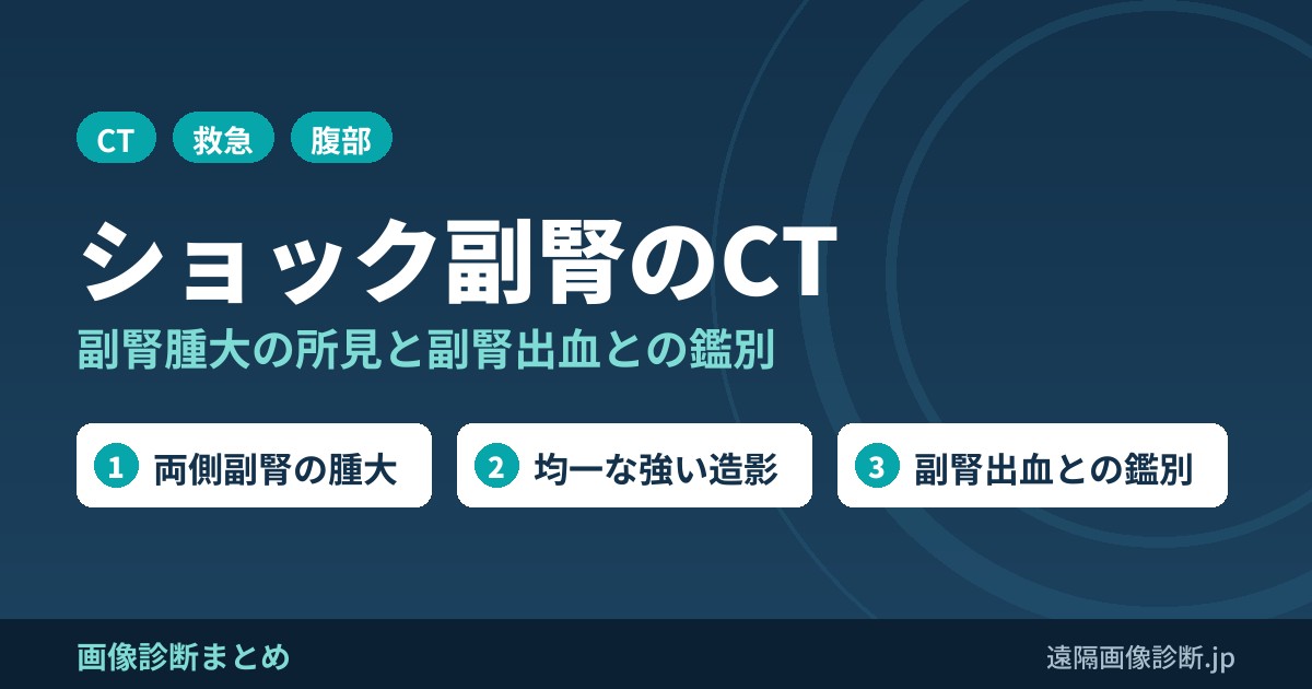 ショック副腎（shock adrenal）の画像診断のポイント