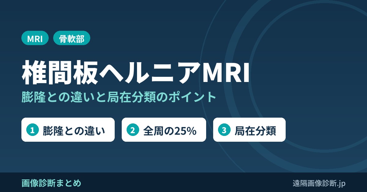 椎間板ヘルニアのMRI画像診断のポイント｜膨隆との違いと局在分類
