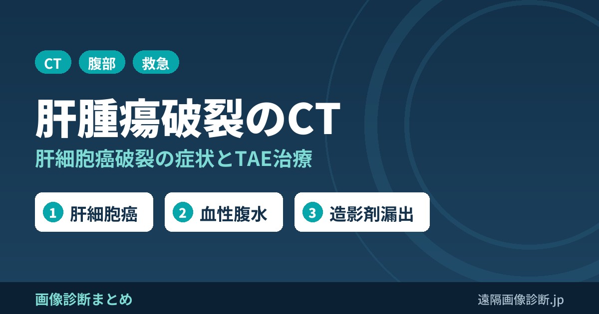 肝腫瘍破裂(肝細胞癌破裂)とは？症状・治療(TAE)とCT画像所見(血性腹水・造影剤漏出)