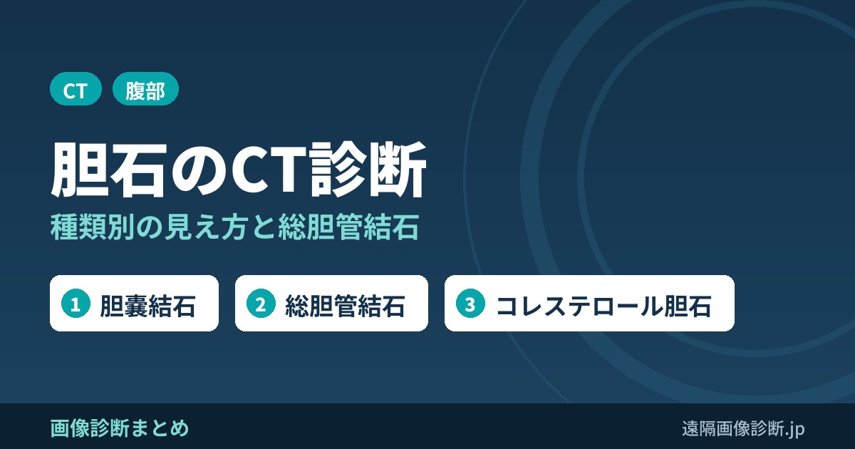 胆石の分類とCT画像診断のポイント｜コレステロール胆石・色素胆石・総胆管結石