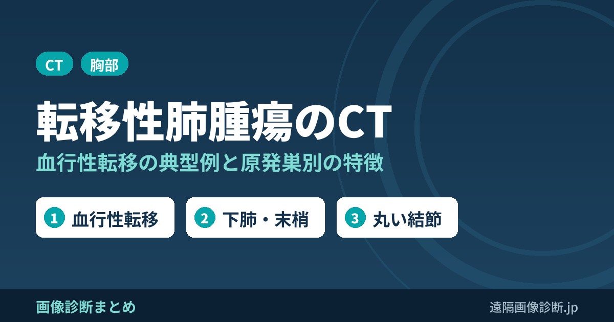 転移性肺腫瘍のCT画像所見｜血行性転移の典型例と原発巣別の特徴