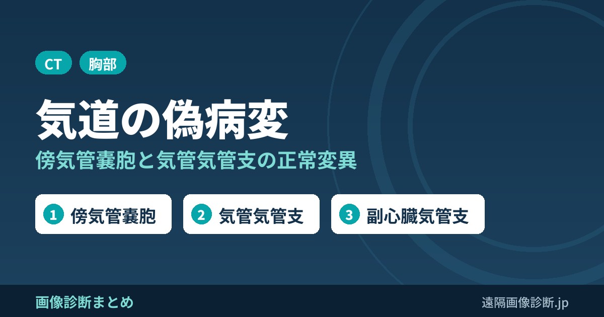 気道の偽病変・正常変異の画像所見｜傍気管嚢胞・気管気管支・副心臓気管支