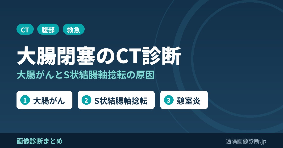 大腸閉塞(大腸の腸閉塞)のCT画像診断｜原因(大腸がん・S状結腸軸捻転)・症状・治療