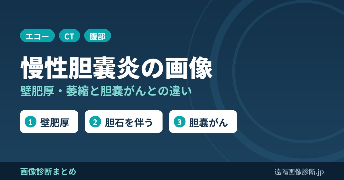 慢性胆嚢炎とは？症状・原因と超音波・CT・MRI画像所見(壁肥厚・萎縮)、胆嚢がんとの違い